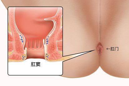 肛窦解剖图 肛窦解剖图谱