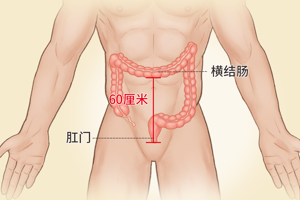 横结肠距肛门60厘米图（横结肠较长怎么办）