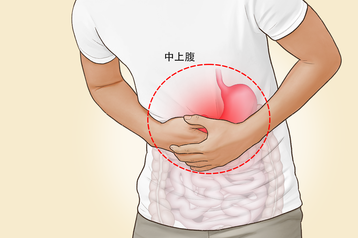 慢性胃炎疼痛部位图片（慢性胃炎疼痛部位图片女性）